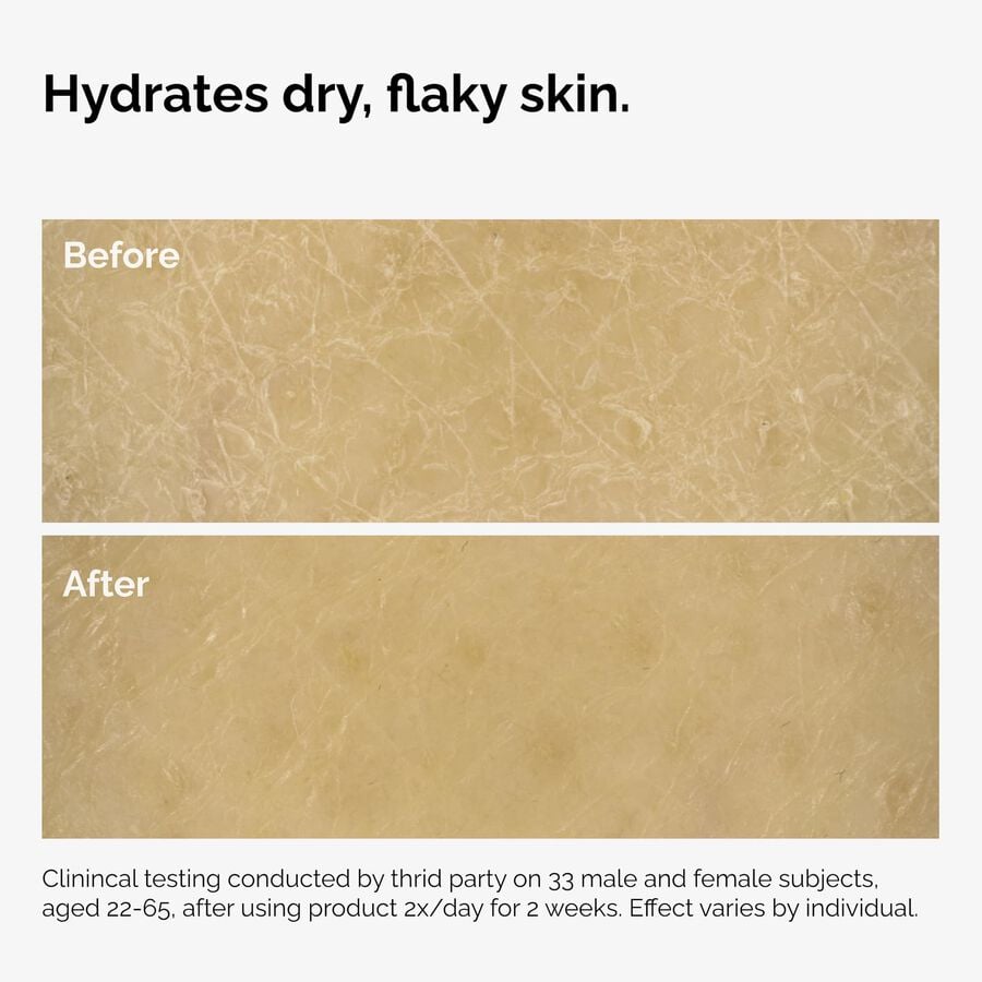 the-body-care-collection-q9 ord-natural-moisturizing-factors-inulin-body-before-after-graphic-02.jpg