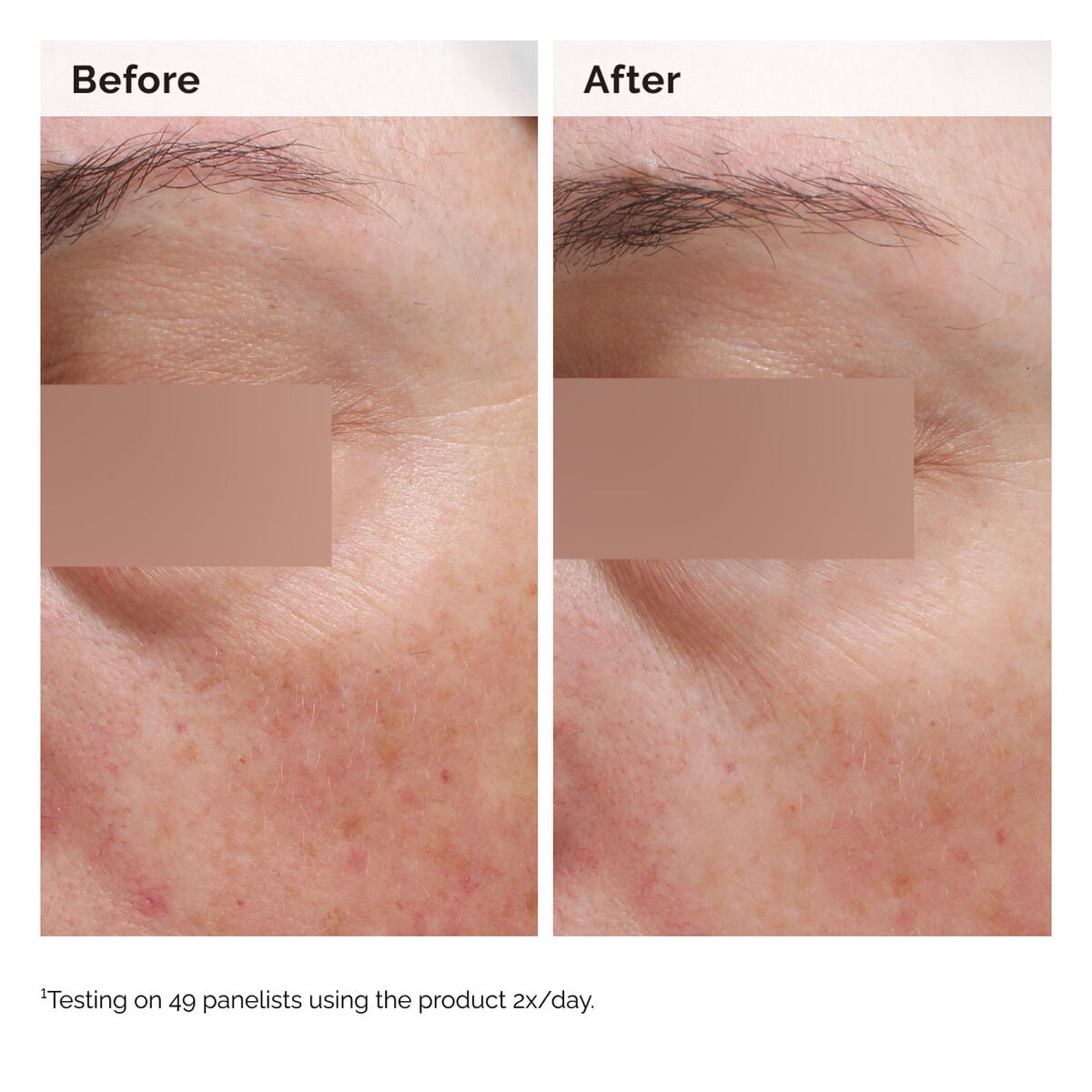 niacinamide-5-face-and-body-emulsion-z9 2024-08-23-ORD-Nia-5pct-Face-Body-B-A-Elasticity-Global-02-1x1.jpg