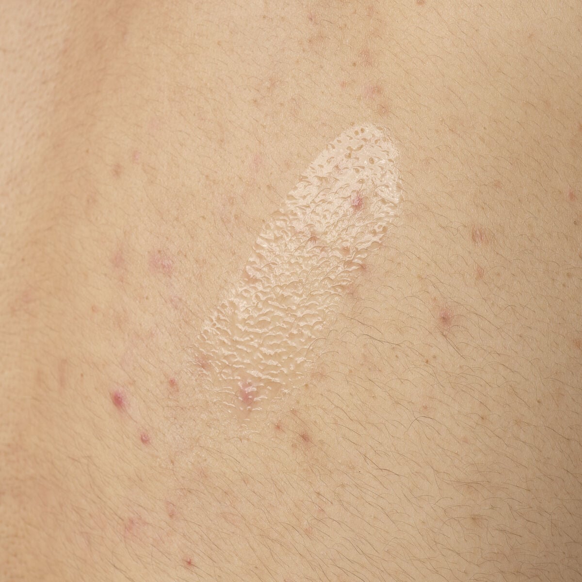 salicylic-acid-0-5-body-serum-m6 ORD-salicylic-acid-05-body-240ml-application.jpg