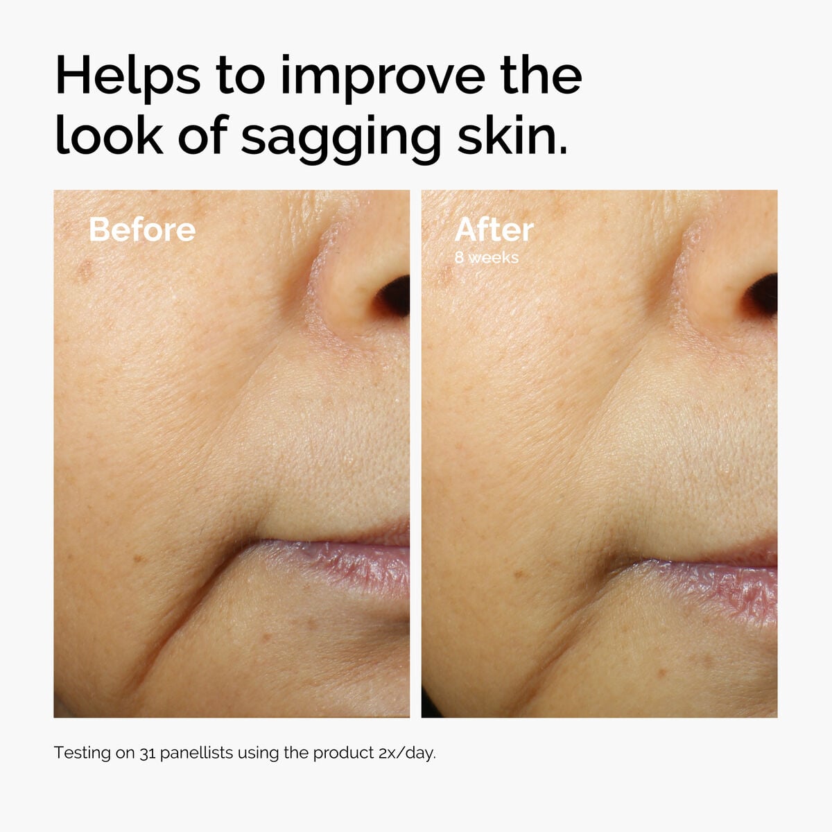 caffeine-3-escin-1-face-serum-d8 ord-caffeine-3pct-escin-1pct-face-serum-before-after-sagging.jpg