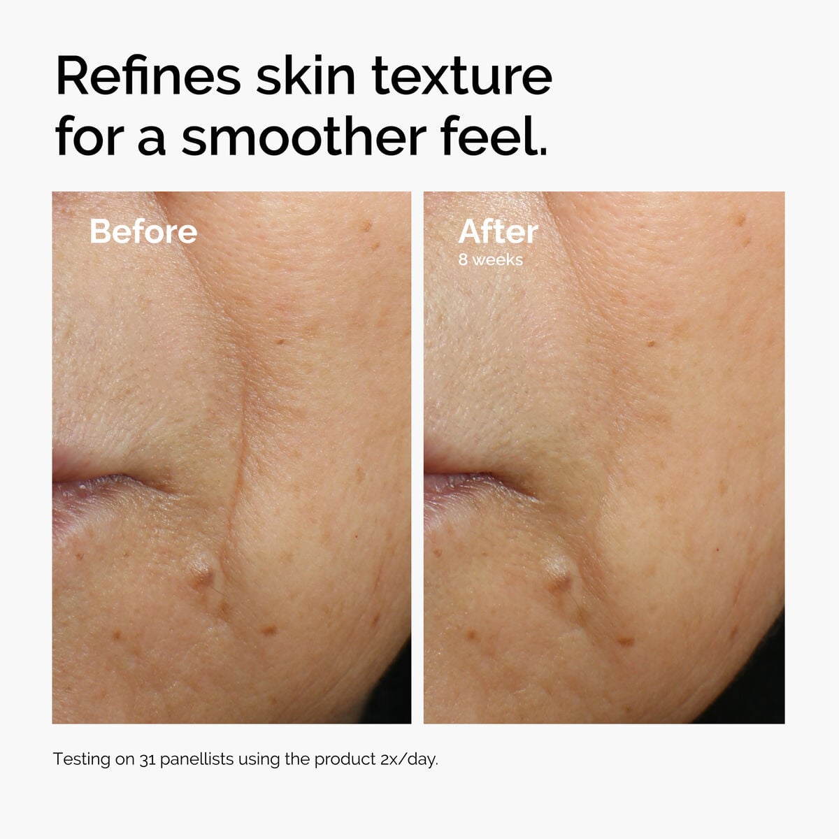 caffeine-3-escin-1-face-serum-d8 ord-caffeine-3pct-escin-1pct-face-serum-before-after-texture.jpg