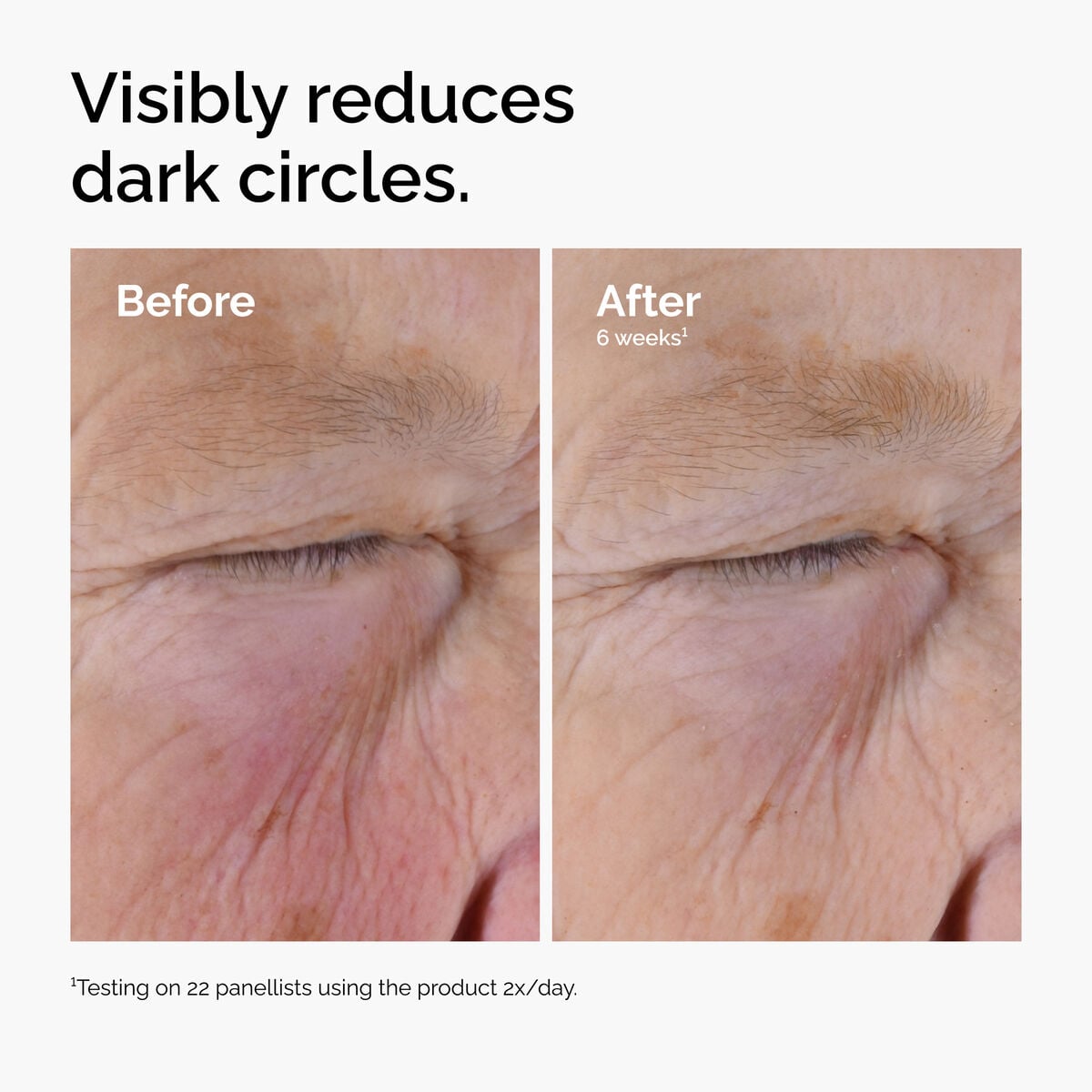 caffeine-solution-5-egcg-eye-serum-i6 ord-caffeine-solution-egcg-dark-circles-before-after.jpg