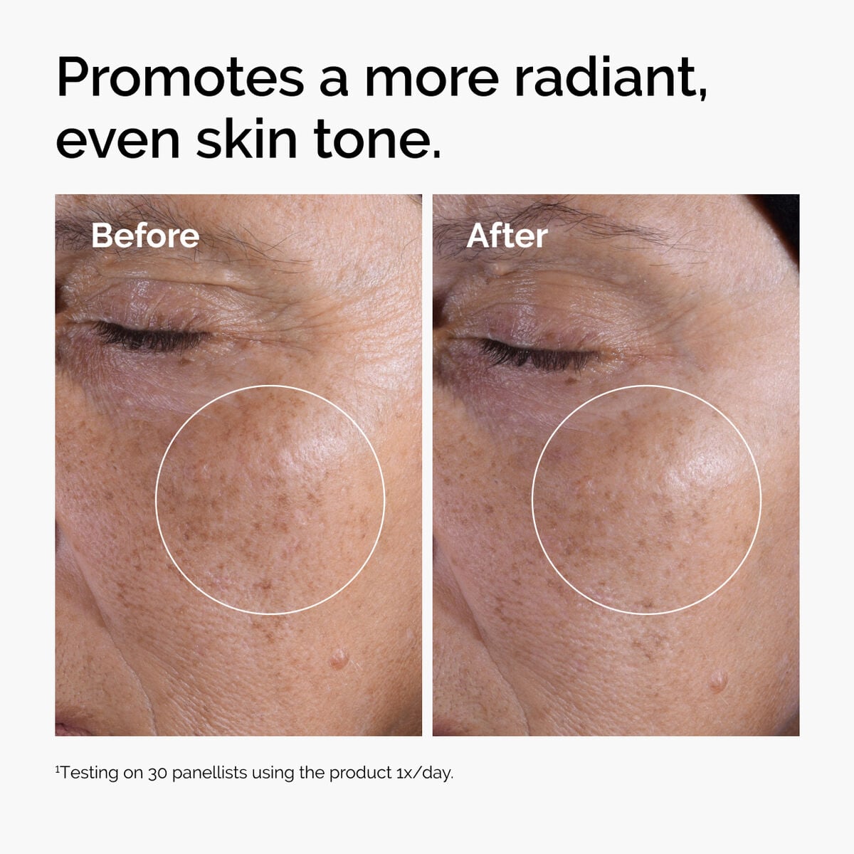 glycolic-acid-7-exfoliating-toner-i2 ord-glycolic-before-after-radiance.jpg