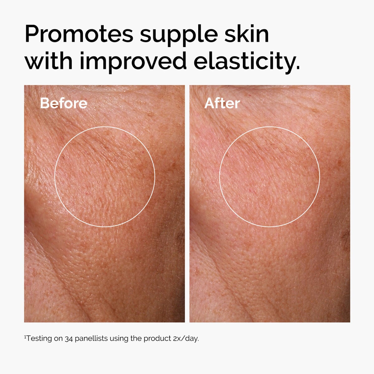 hyaluronic-acid-2-b5-with-ceramides-g2 ord-hyaluronic-acid-2pct-b5-hydrating-serum-before-after-elasticity.jpg