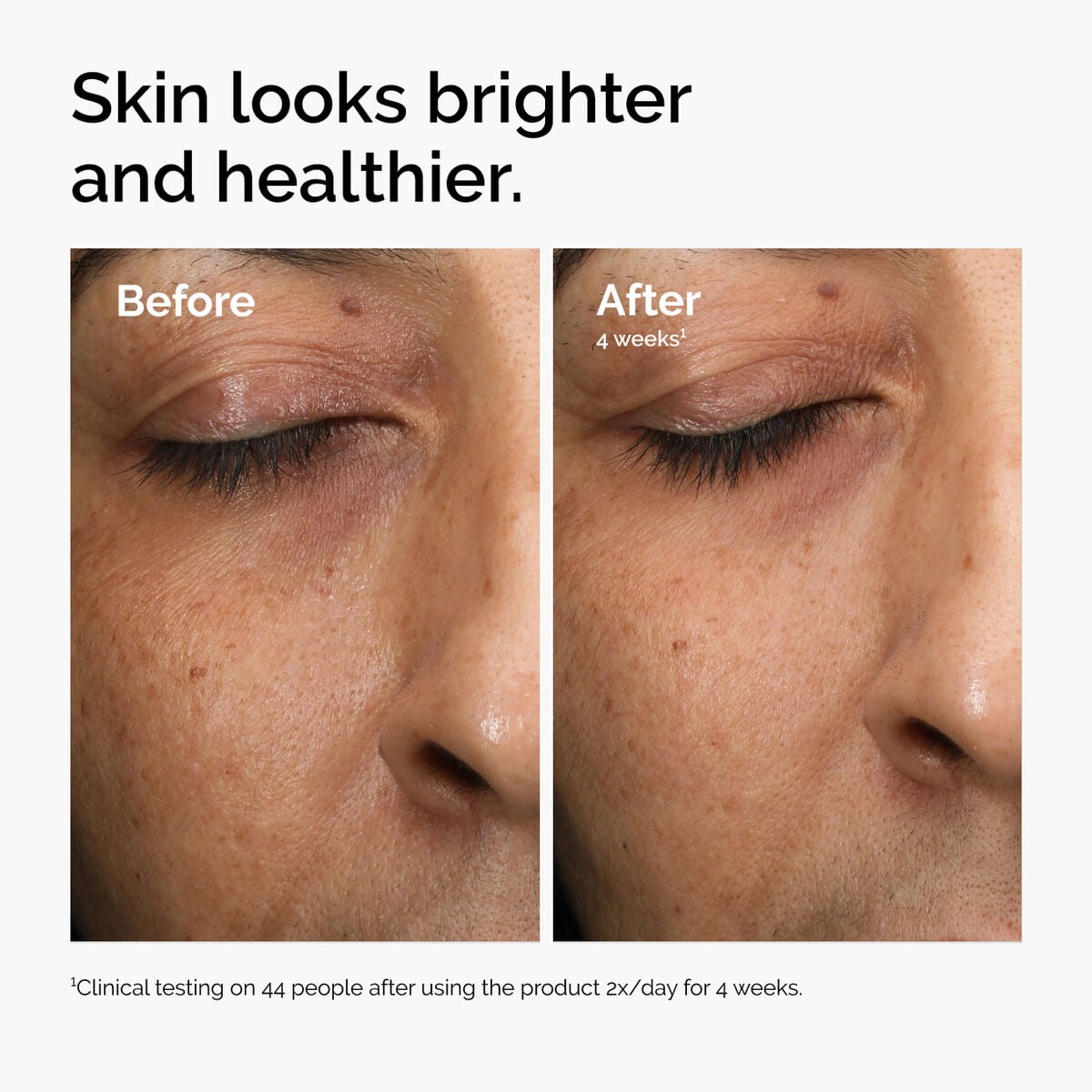 multi-antioxidant-radiance-serum-e0 ord-mars-before-after-healthy.jpg