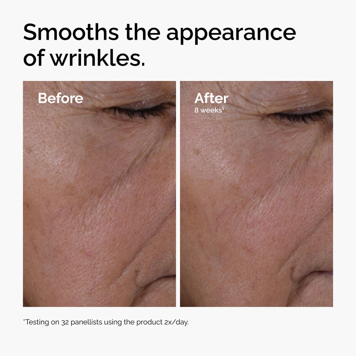 multi-peptide-ha-serum-a2 ord-multi-peptide-ha-serum-wrinkles-before-after.jpg
