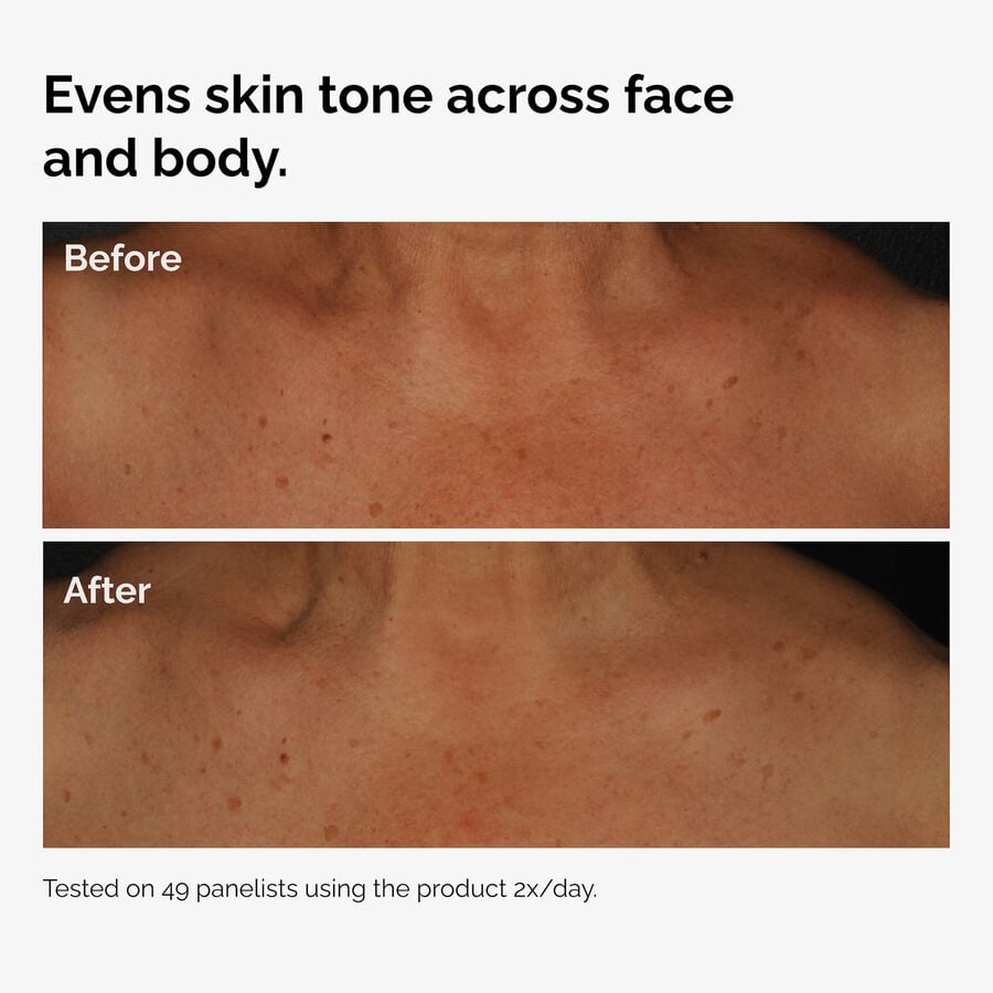 the-body-care-collection-q9 ord-niacinamide-face-body-serum-before-after-even-tone-graphic.jpg